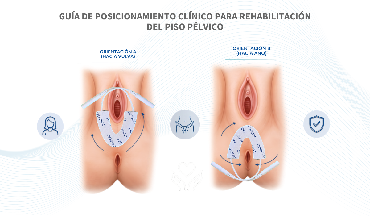 Electrodo Perineal Tipo Herradura | Guía de Aplicación Clínica