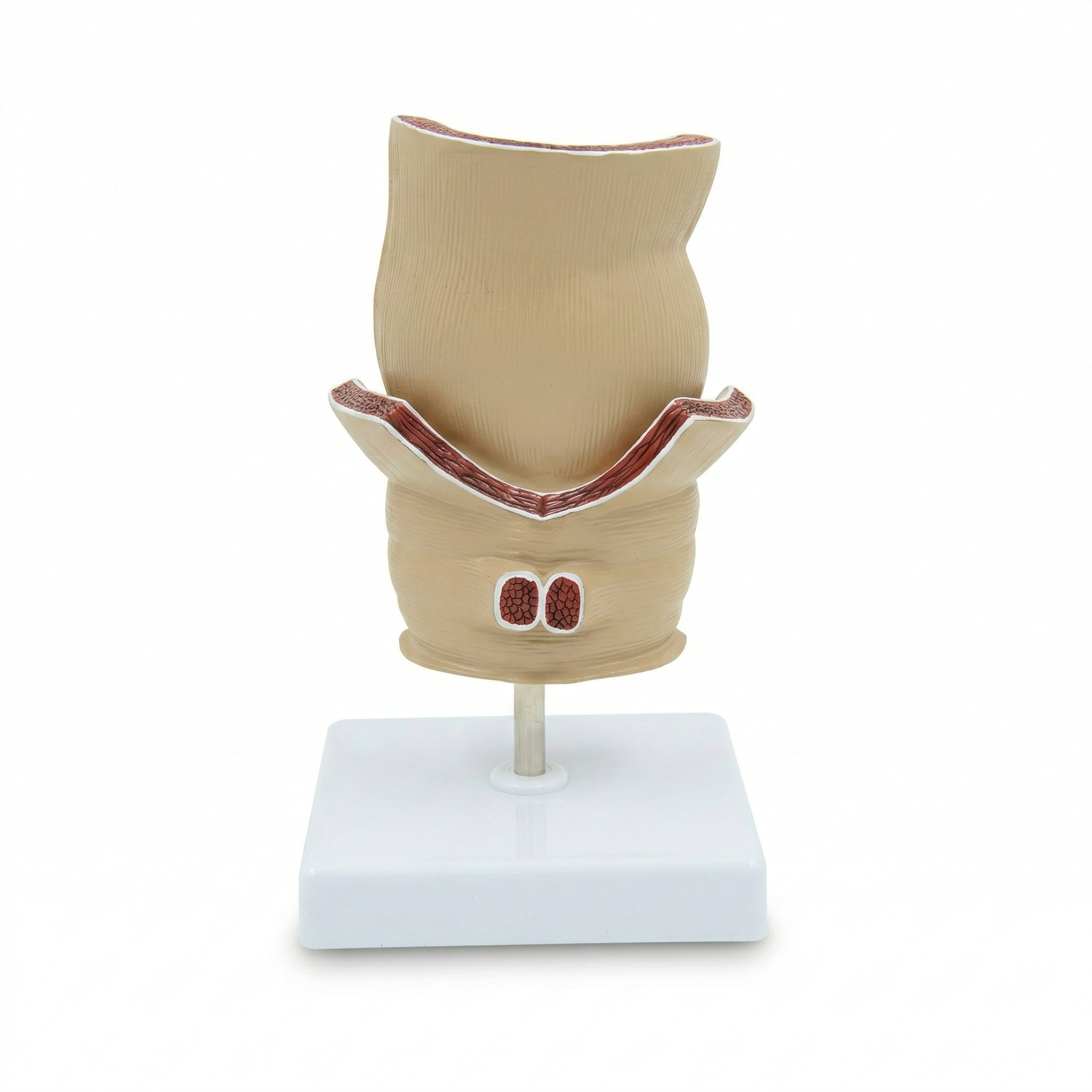 Modelo Patología Rectal